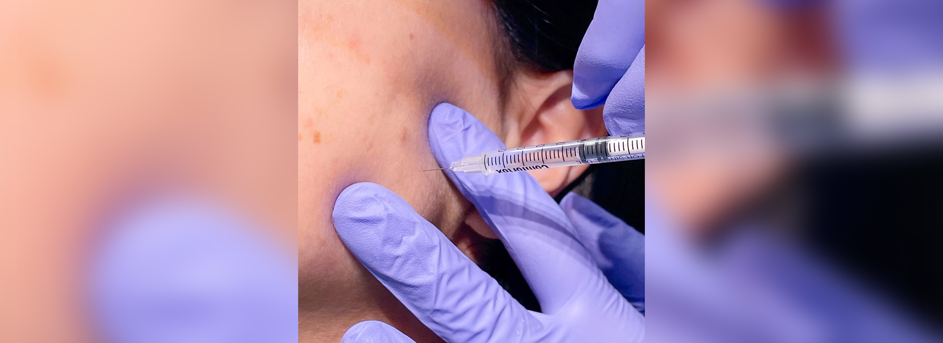 TMJ Treatment