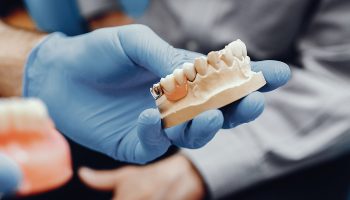 Looking for Affordable Dental Bridges in Miami? Here’s What You Need to Know!