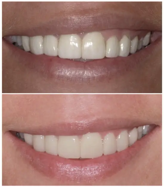 Treatment Results at ONE Dental