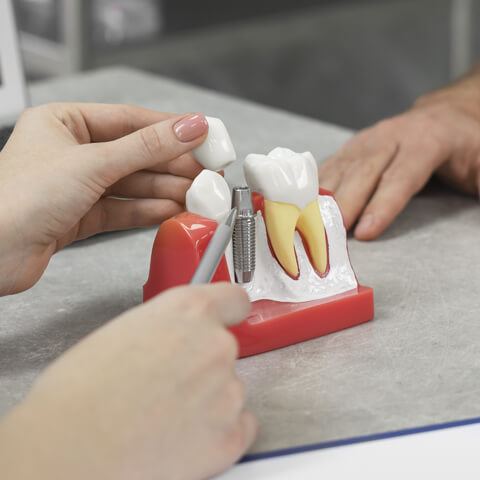 Implant Dentistry