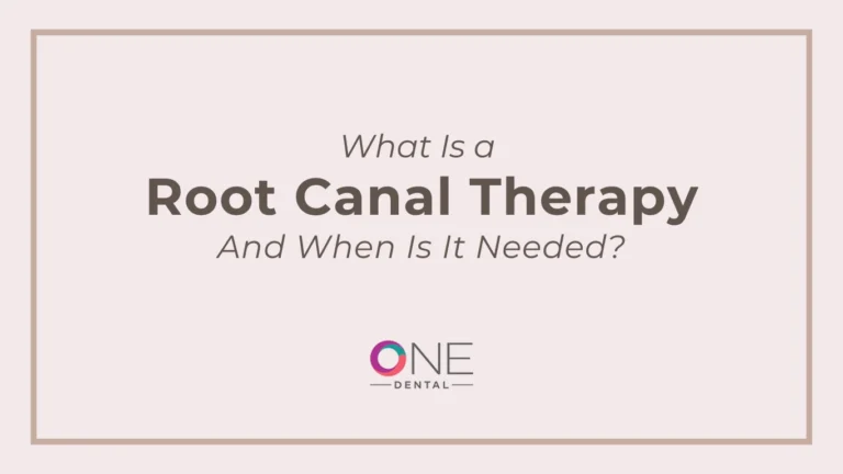 What Is a Root Canal Therapy and When Is It Needed?