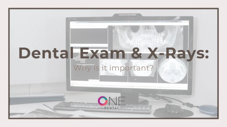 Why Dental Exams Are Essential